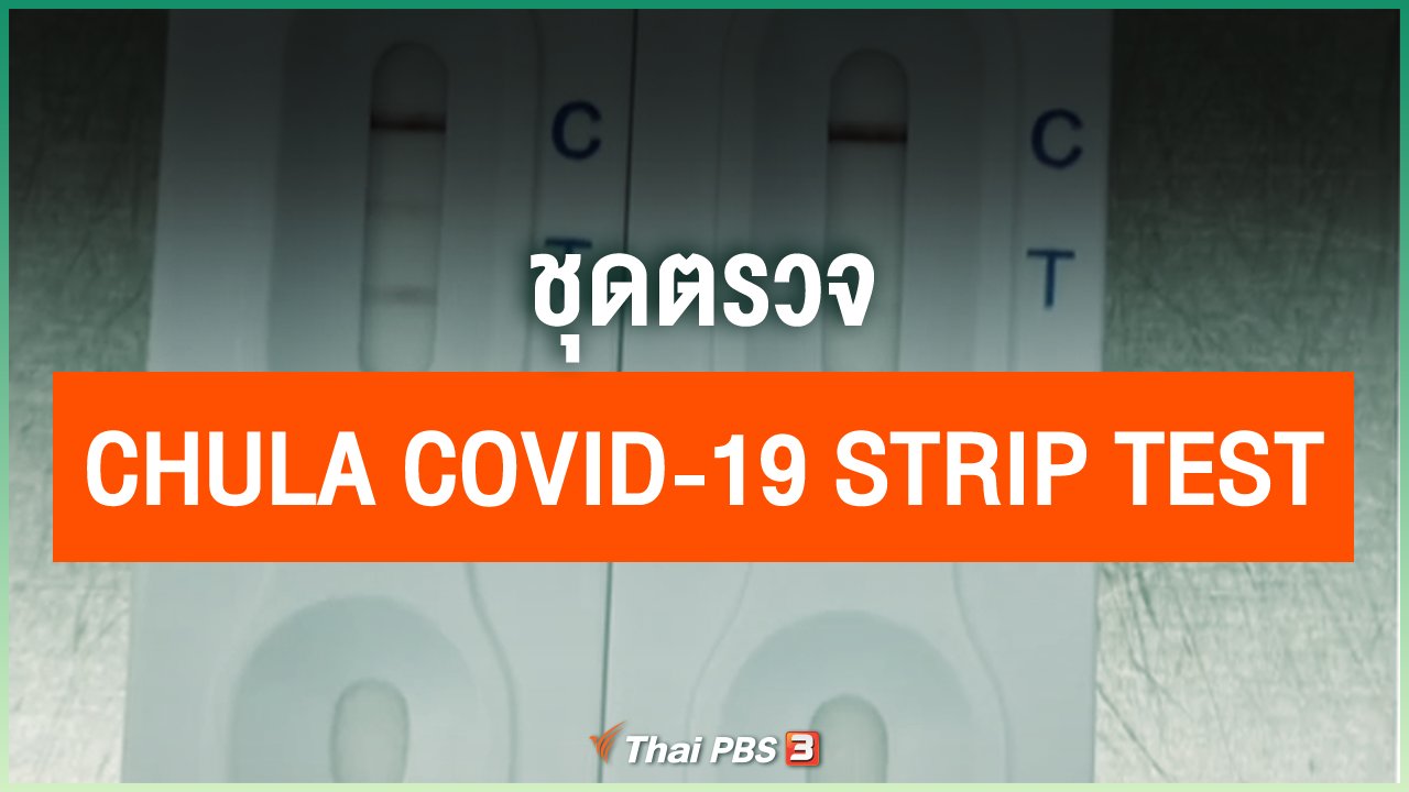 Coronavirus - ชุดตรวจ Chula COVID-19 Strip Test