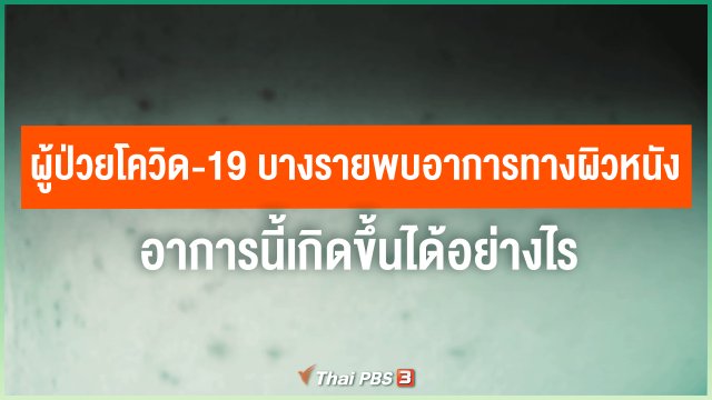 ​ผู้ป่วยโควิด-19 บางรายพบอาการทางผิวหนัง อาการนี้เกิดขึ้นได้อย่างไร