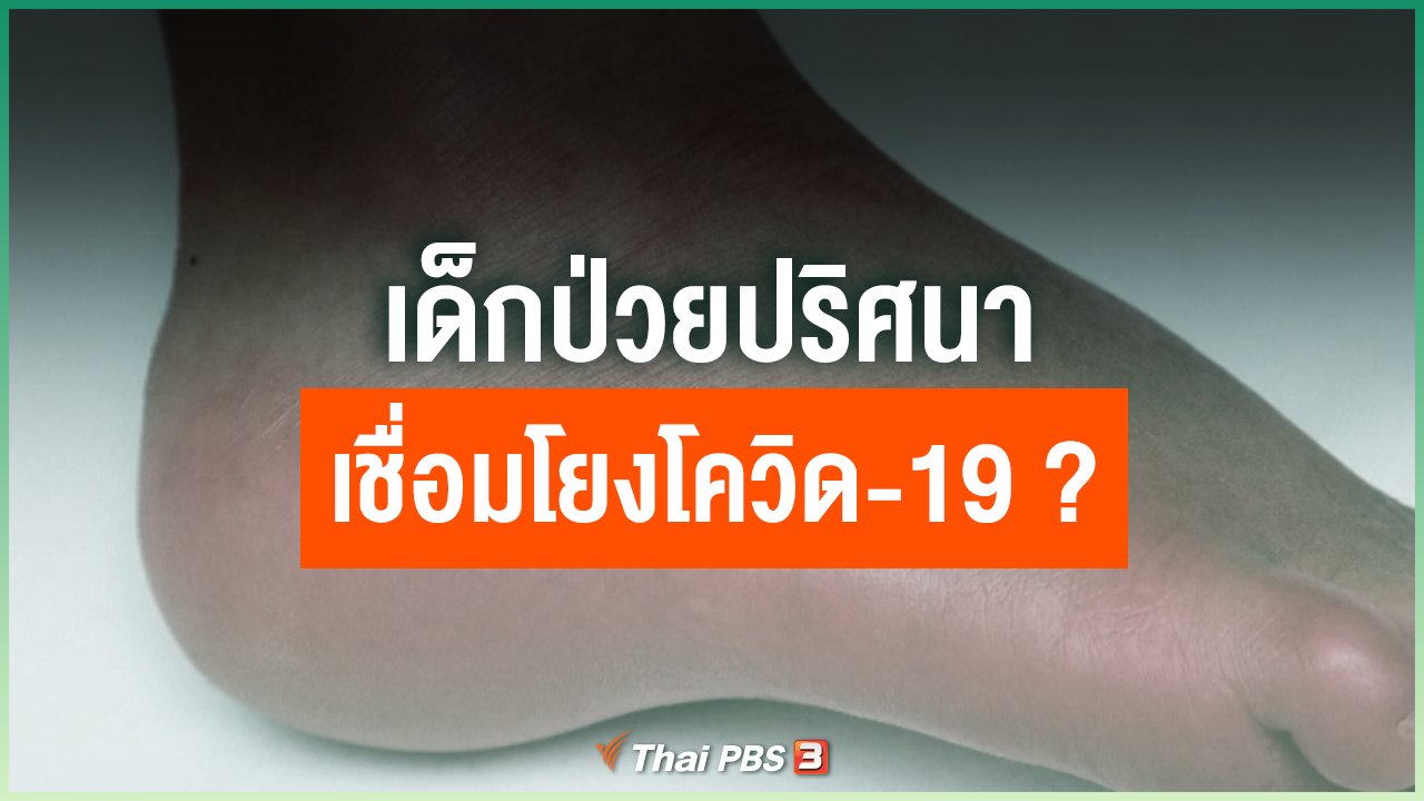 Coronavirus - เด็กป่วยปริศนาเชื่อมโยงโควิด-19 ?