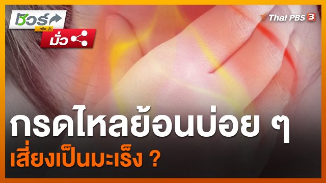 ชัวร์หรือมั่ว : คนที่มีอาการกรดไหลย้อนบ่อย ๆ เสี่ยงเป็นมะเร็ง ?