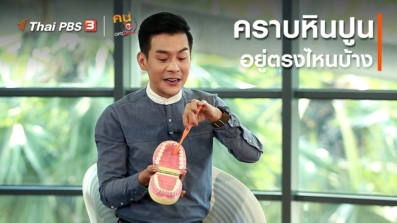 คนสู้โรค - รู้สู้โรค : คราบหินปูน อยู่ตรงไหนบ้าง