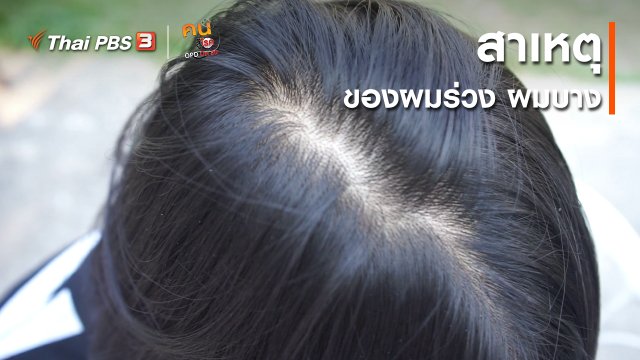 รู้สู้โรค : สาเหตุของผมร่วง ผมบาง