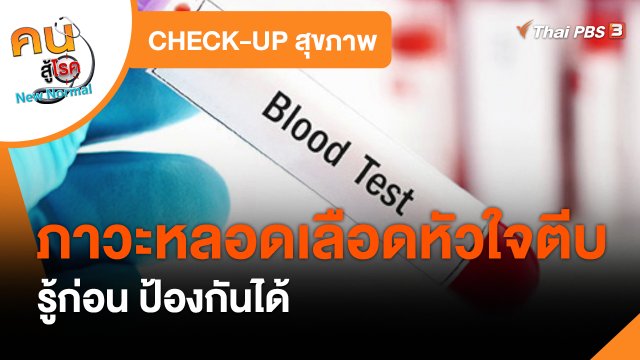 CHECK-UP สุขภาพ : ภาวะหลอดเลือดหัวใจตีบ