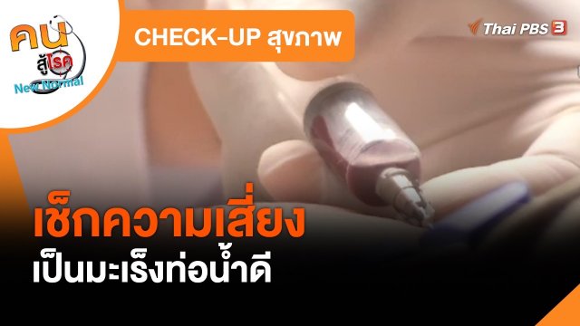 CHECK-UP สุขภาพ : เช็กความเสี่ยงเป็นมะเร็งท่อน้ำดี