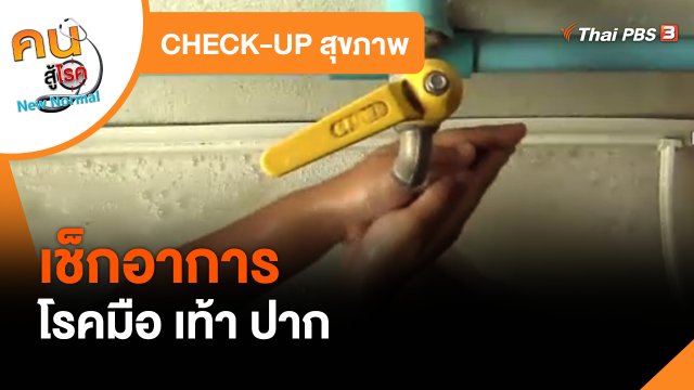 CHECK-UP สุขภาพ : เช็กอาการโรคมือ เท้า ปาก
