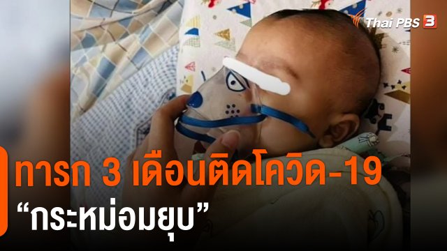 ​ทารก 3 เดือนติดโควิด-19 “กระหม่อมยุบ”